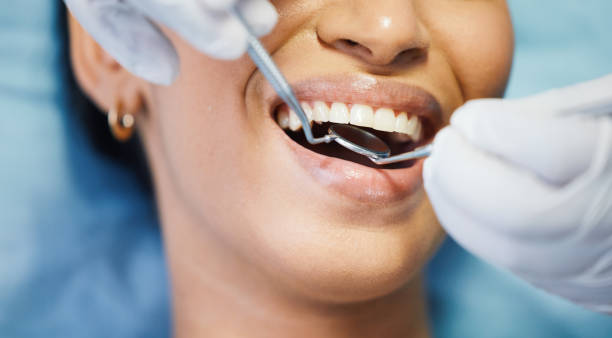 Best Urgent Care for Lost Fillings or Crowns in Birch Bay, WA